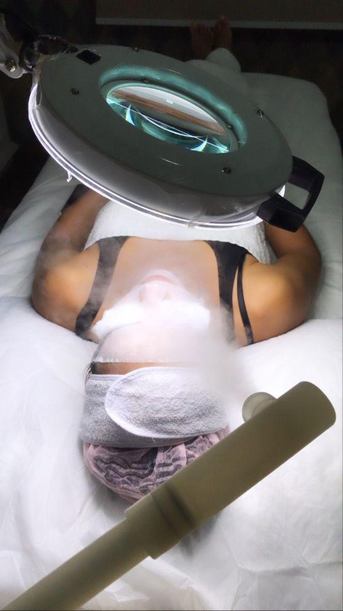 Peeling Facial Profesional exfoliante